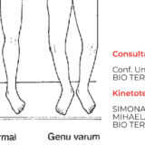 Deviatiile de ax ale genunchilor