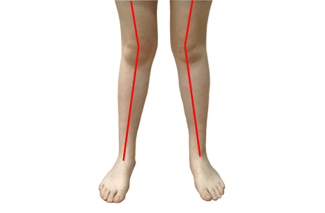 deformarea articulațiilor genunchiului artroza mainii