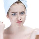 10 obiceiuri ce pot agrava acneea