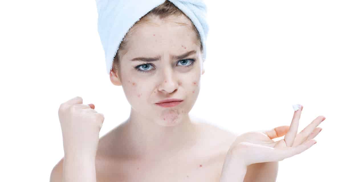 10 obiceiuri ce pot agrava acneea