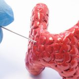 Endocrinologie - noduli tiroidieni - punctia aspirativa cu ac fin