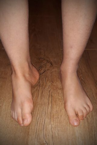 unghiile de glezna de entorsa inflamația tratamentului gleznei piciorului