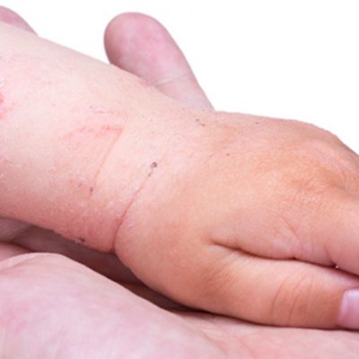 Dermatologie-Kids-Movement